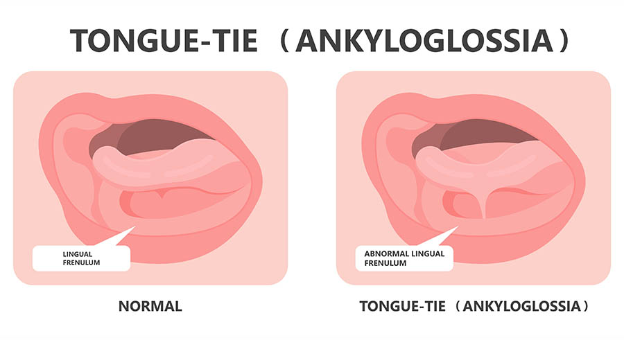 SKY Periodontics and Implant Dentistry | Initial Exam, Causes of Periodontal Disease and Types of Periodontal Disease
