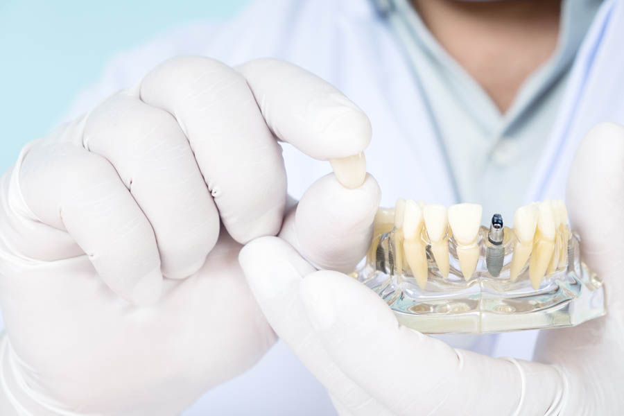 SKY Periodontics and Implant Dentistry | Treatment of Periodontal Disease, Frenectomy and Soft Tissue Grafts